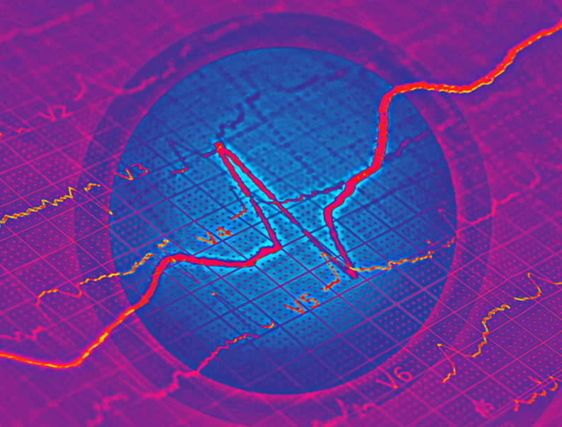 Google’s Algorithm Update ‘Fred’ & the Larger Algorithm Picture